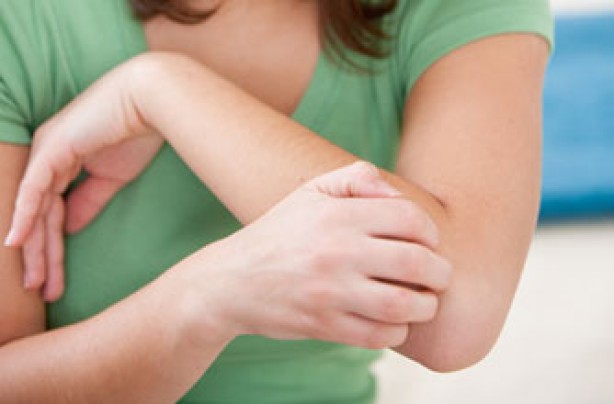 apple cider vinegar itchy skin remedy